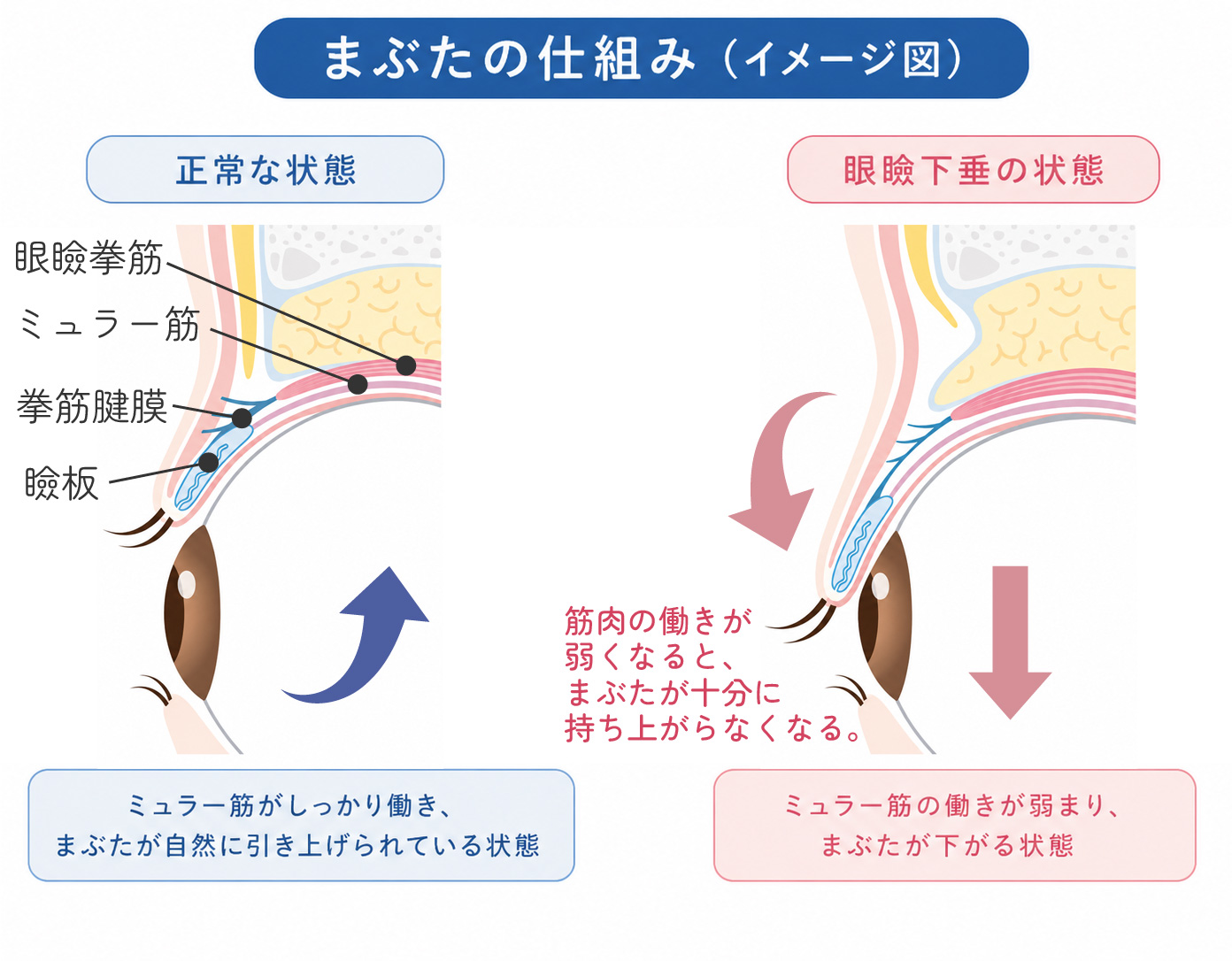 まぶたの仕組み（イメージ図）