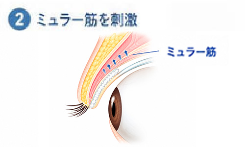 ミュラー筋を刺激